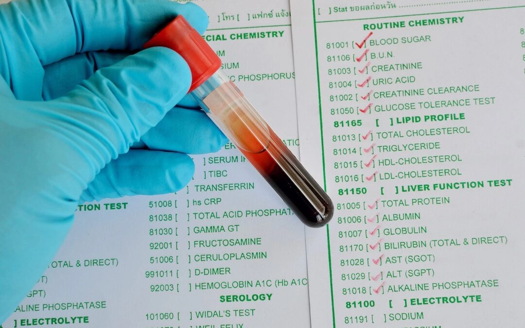 Function medicine Hashimoto’s hyperthyroidism